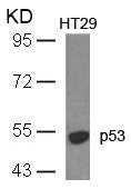 TP53 (Ab-18) Antibody