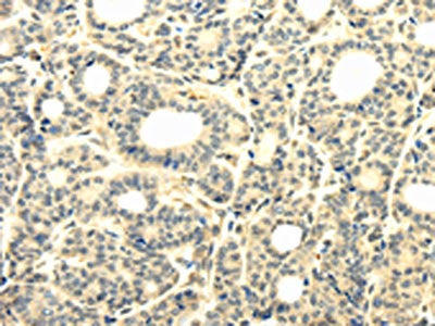 TBC1D22A Antibody