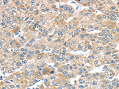 LEFTY2 Antibody