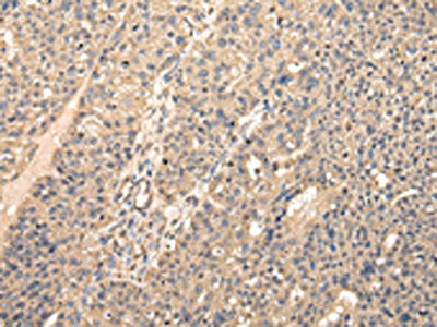 VPS28 Antibody