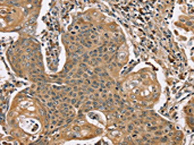 SCGB2A1 Antibody