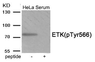 Phospho-BMX (Tyr566) Antibody