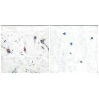ARC Antibody