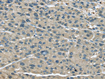 UGP2 Antibody