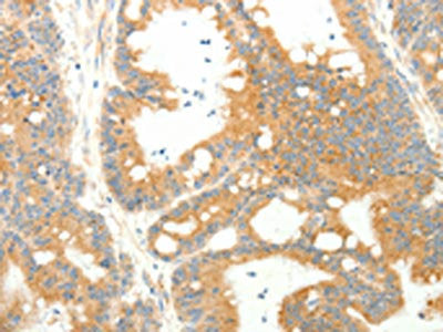 AGRP Antibody