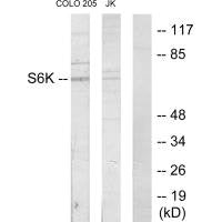 RPS6KB1 Antibody