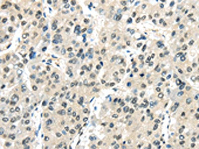 MED18 Antibody