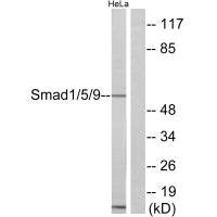 SMAD1 Antibody