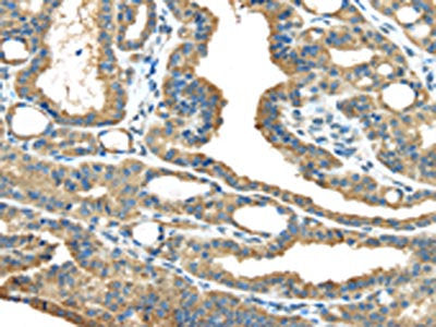 ERP44 Antibody