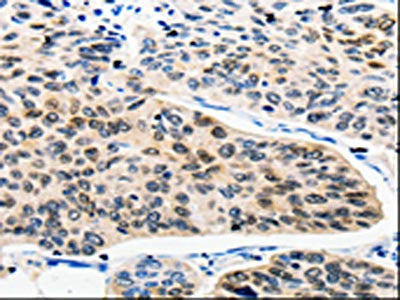 RAN Antibody