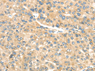 TRAK1 Antibody
