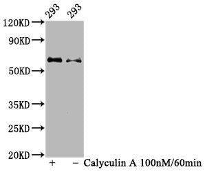 Phospho-AKT1 (Ser473) Antibody