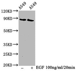 Phospho-BRAF (T401) Antibody