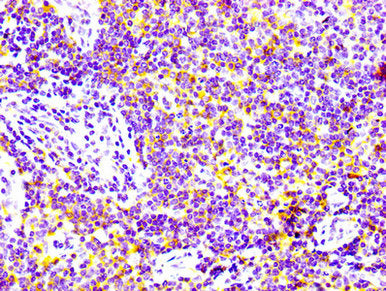 CD97 Antibody