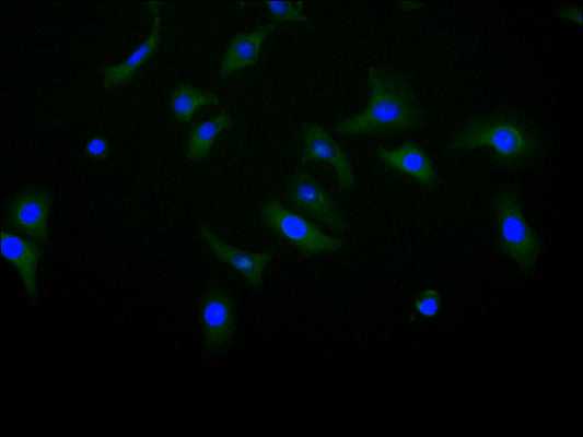 CDH11 Recombinant Monoclonal Antibody