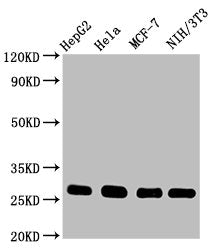 CDKN1B Antibody