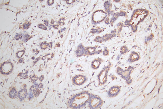 CTNNB1 Recombinant Monoclonal Antibody
