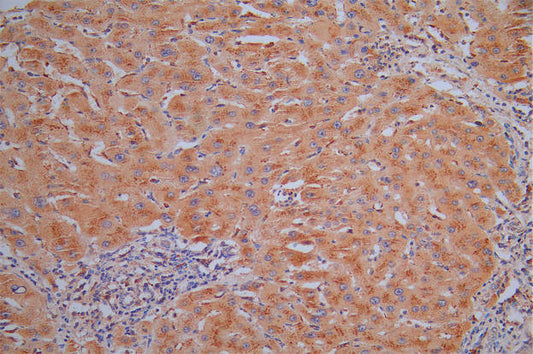 CTSL Recombinant Monoclonal Antibody