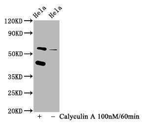 Phospho-EIF2AK2 (T446) Antibody