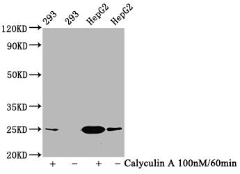 Phospho-EIF4E (S209) Antibody