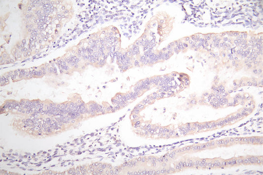 EPCAM Recombinant Monoclonal Antibody