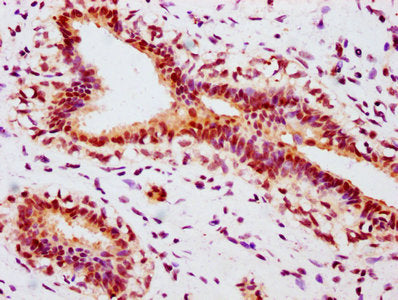 Phospho-ESR1 (S118) Antibody