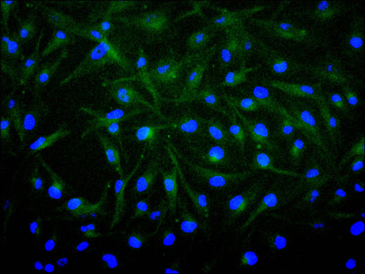 FGF1 Recombinant Monoclonal Antibody