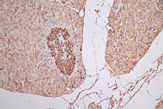 FGFR1 Recombinant Monoclonal Antibody