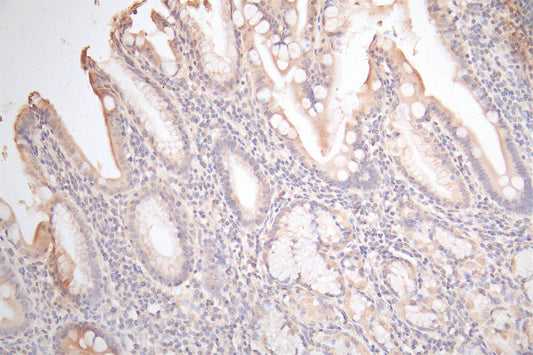 GJB2 Recombinant Monoclonal Antibody