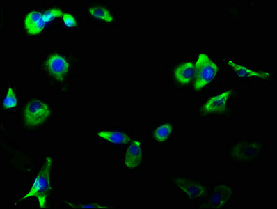 GRIA2/GRIA3 Antibody