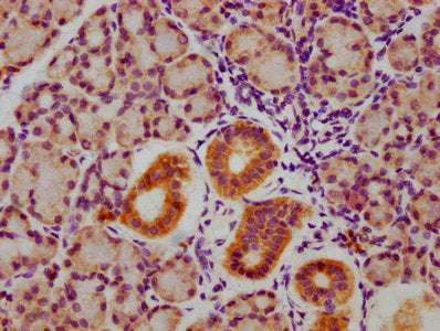 Phospho-GSK3A/GSK3B (Y216 + Y279) Antibody