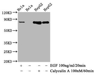 Phospho-GYS1 (S641) Antibody