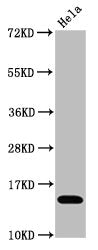 Acetyl-Histone H3.1（K4）Antibody