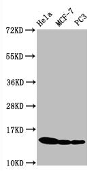 Phospho-Histone H3.1（S10）Antibody