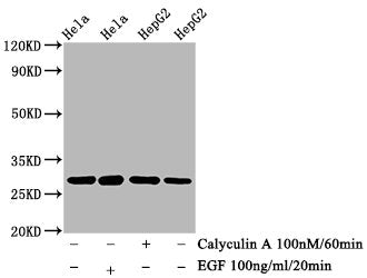 Phospho-HSPB1 (S82) Antibody