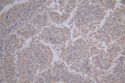 HSPB1 Recombinant Monoclonal Antibody