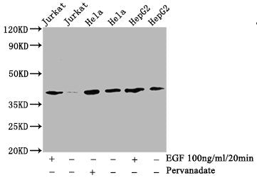 Phospho-LAT (Y191) Antibody
