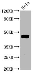 Phospho-MAP2K1 (T292) Antibody