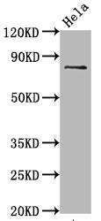 Phospho-MAPT (S396) Antibody