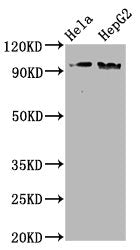 Phospho-NBN (S343) Antibody