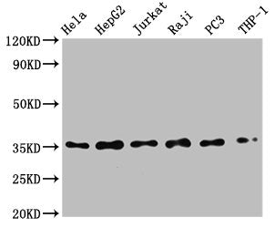 NFKBIA Antibody