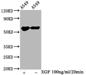 Phospho-PAK1/PAK2/PAK3 (S144+S141+S139) Antibody
