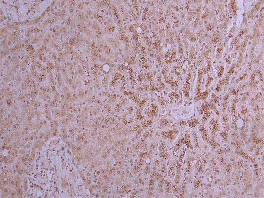 PCSK9 Recombinant Monoclonal Antibody