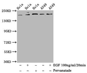 Phospho-PDGFRB (Y740) Antibody