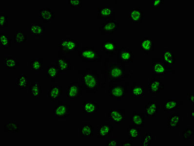 Phospho-PRKDC (S2056) Antibody