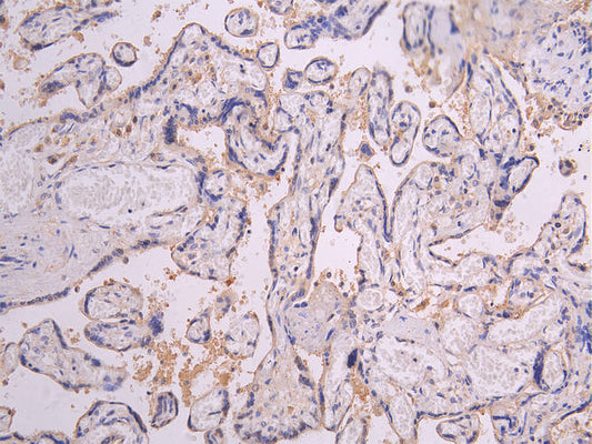 PRLR Recombinant Monoclonal Antibody