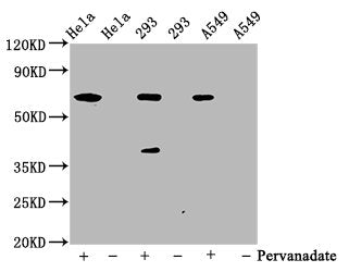 Phospho-PTPN11 (Y542) Antibody