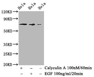 Phospho-RAF1 (S259) Antibody