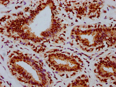 Phospho-RB1 (S780) Antibody