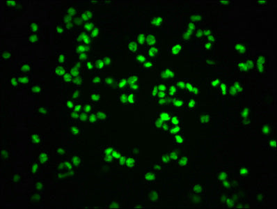 Phospho-RB1 (S807) Antibody
